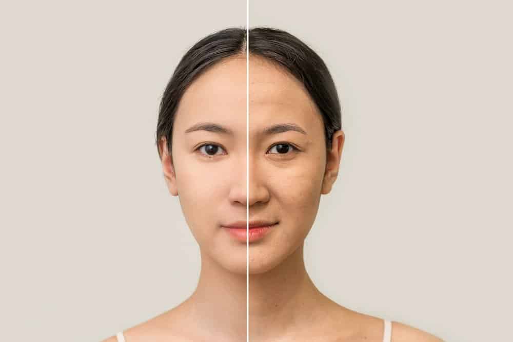 Sai Lầm Phổ Biến Trong Chăm Sóc Da