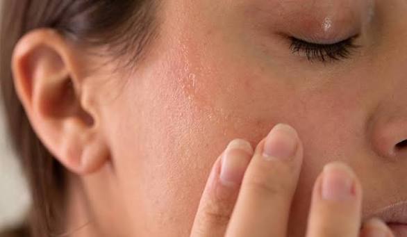 Phục Hồi Làn Da Khô Sạm Và Nhạy Cảm