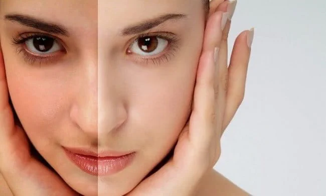 Da Xỉn Màu, Kém Sức Sống