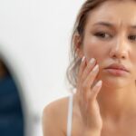 Da Xỉn Màu, Kém Sức Sống