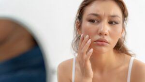 Da Xỉn Màu, Kém Sức Sống