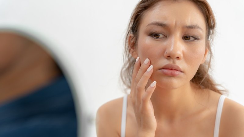Da Xỉn Màu, Kém Sức Sống